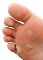 Traitement et soins des pieds